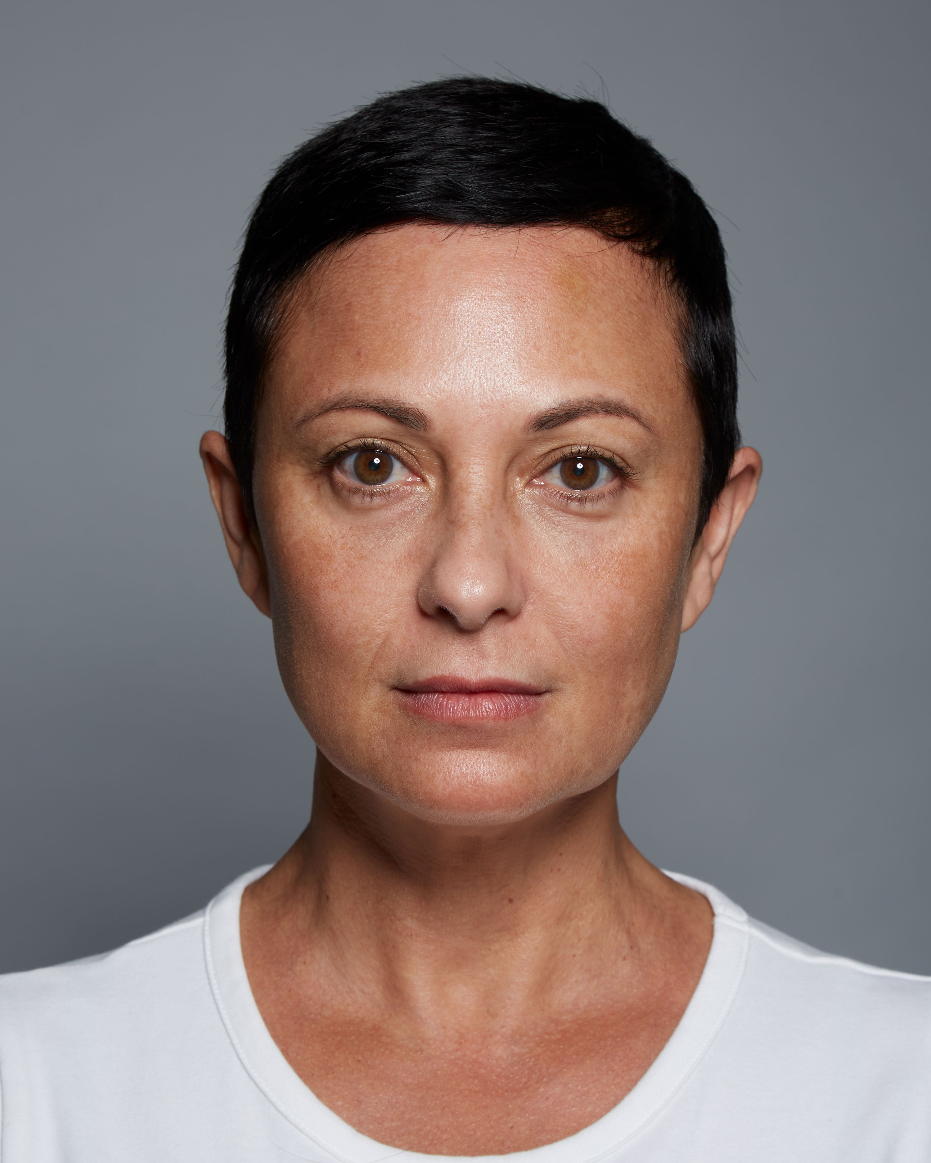 "After" headshot of a clinical subject who has used Michal Morrison Genesis BSTEM6 Molecular Serum, showing a woman with short brown hair and a white shirt looking at camera.