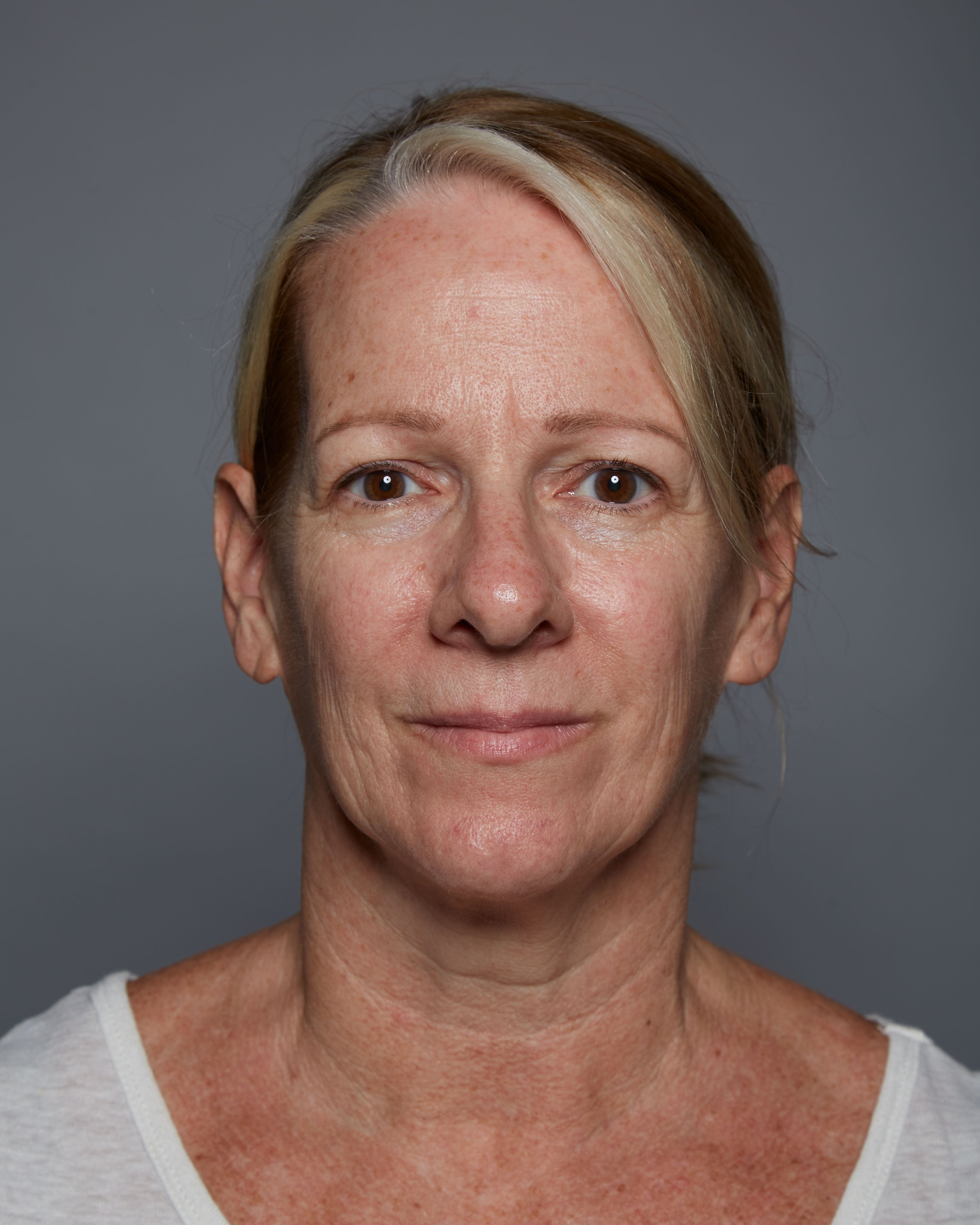 "After" headshot of a clinical subject who has used Michal Morrison Genesis BSTEM6 Molecular Serum, showing a white woman with blonde hair smiling at camera.