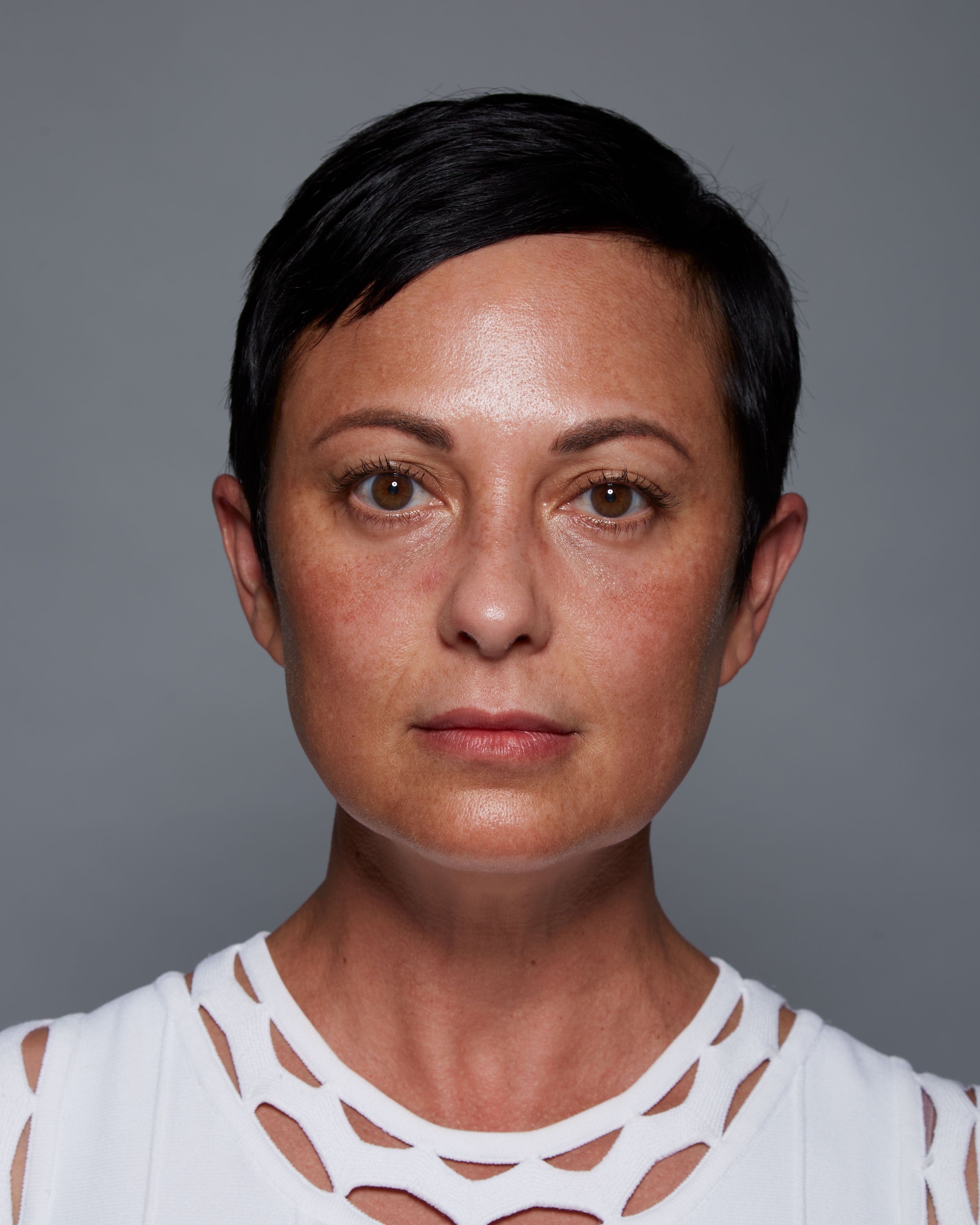 The "Before" headshot of a clinical subject who has used Michal Morrison Genesis BSTEM6 Molecular Serum, showing a woman with short brown hair and a white shirt looking at the camera.
